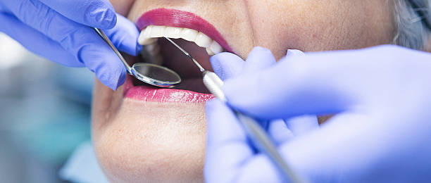 Best Broken or Chipped Tooth Repair in Spicer, MN